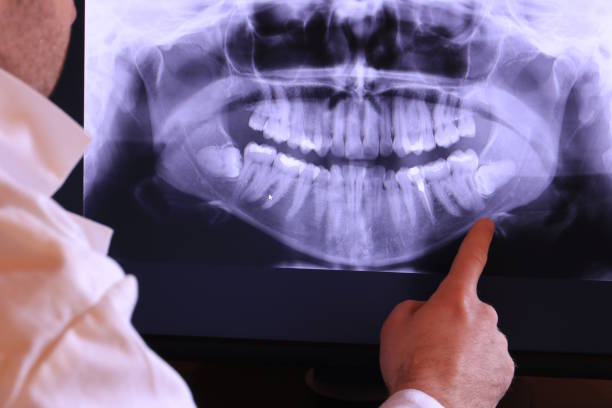 Best Emergency Tooth Extraction  in New Hackensack, NY