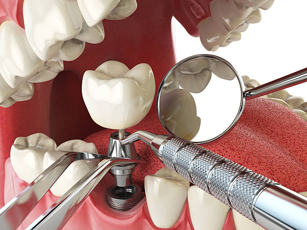 Best Emergency Tooth Extraction  in New Hackensack, NY